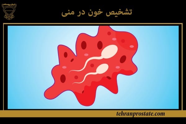 علت خون در منی (هماتواسپرمی): علل، علائم و درمان 1 تشخیص خون در منی