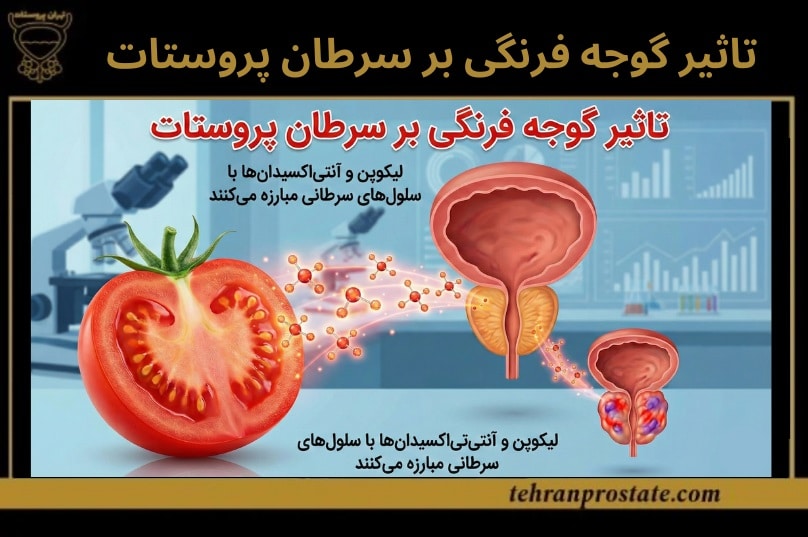 کلینیک تهران پروستات مرکز تخصصی درمان سرطان پروستات 16 تاثیر گوجه فرنگی بر سرطان پروستات