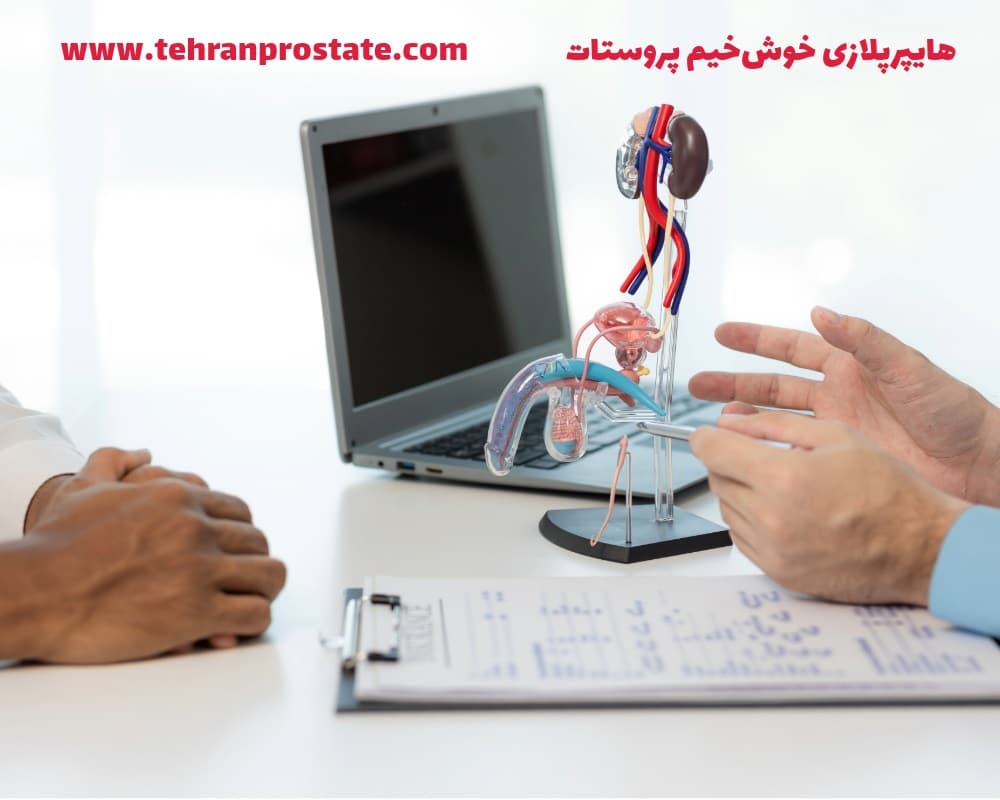 هایپرپلازی خوش‌خیم پروستات