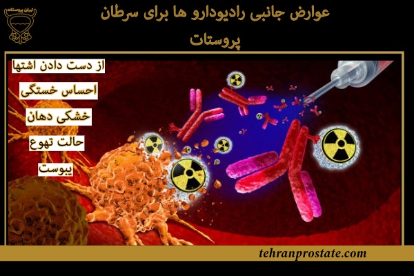 عوارض جانبی رادیودارو ها برای سرطان پروستات