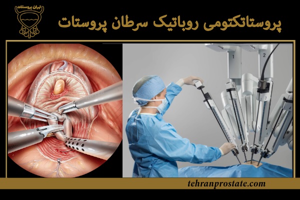 پروستاتکتومی روباتیک سرطان پروستات