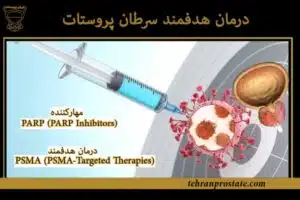 درمان هدفمند سرطان پروستات