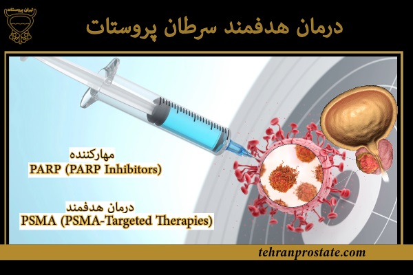 درمان هدفمند سرطان پروستات