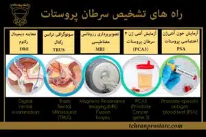 راه های تشخیص سرطان پروستات