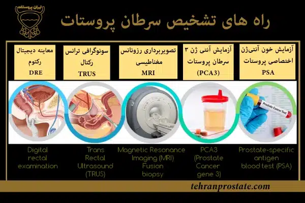 راه های تشخیص سرطان پروستات