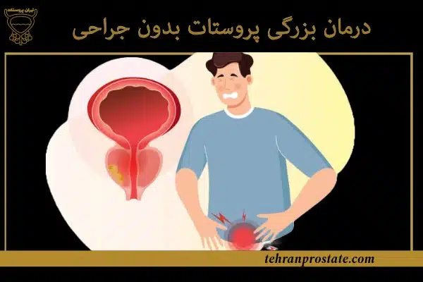 درمان بزرگی پروستات بدون جراحی