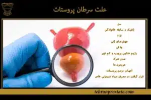 علت سرطان پروستات