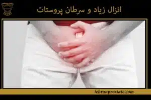 انزال زیاد و سرطان پروستات