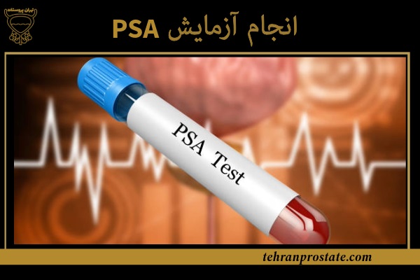انجام آزمایش PSA