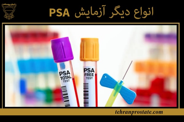 انواع دیگر آزمایش PSA