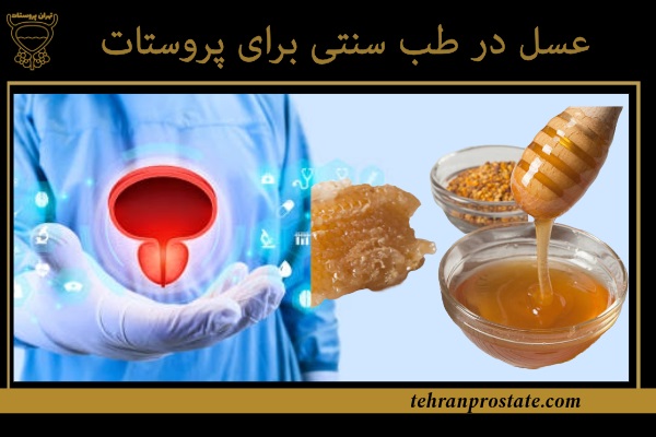 عسل در طب سنتی برای پروستات