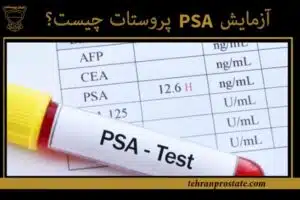 آزمایش PSA چیست