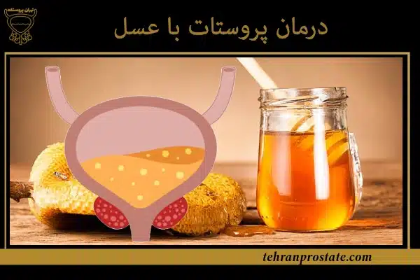 درمان پروستات با عسل