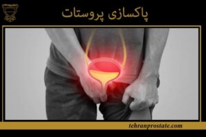 پاکسازی پروستات