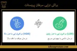 براکی تراپی سرطان پروستات