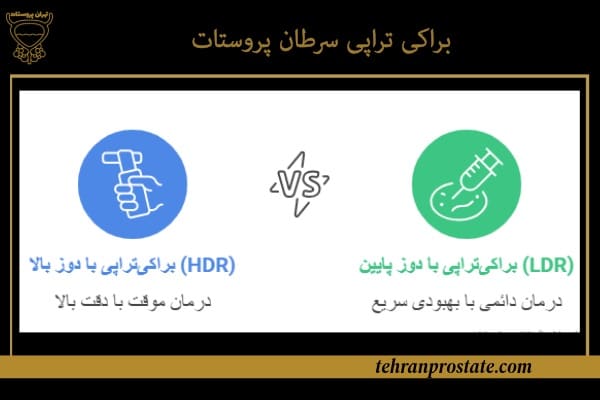 براکی تراپی سرطان پروستات