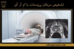 ام‌ آر آی پروستات