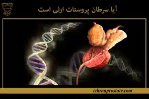 آیا سرطان پروستات ارثی است