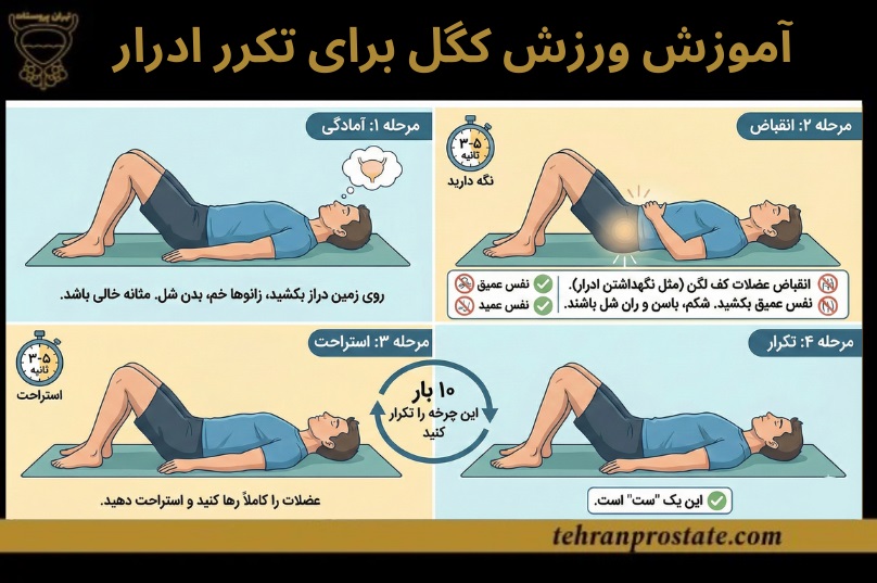 آموزش ورزش کگل برای تکرر ادرار