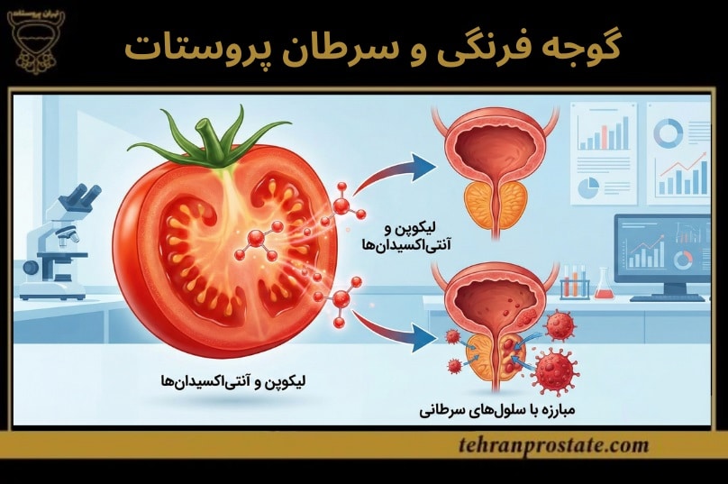 گوجه فرنگی و سرطان پروستات